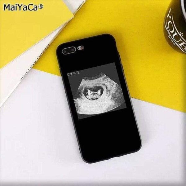 Frenchie World Shop For iphone X or XS / A11 Frenchies iPhone Case